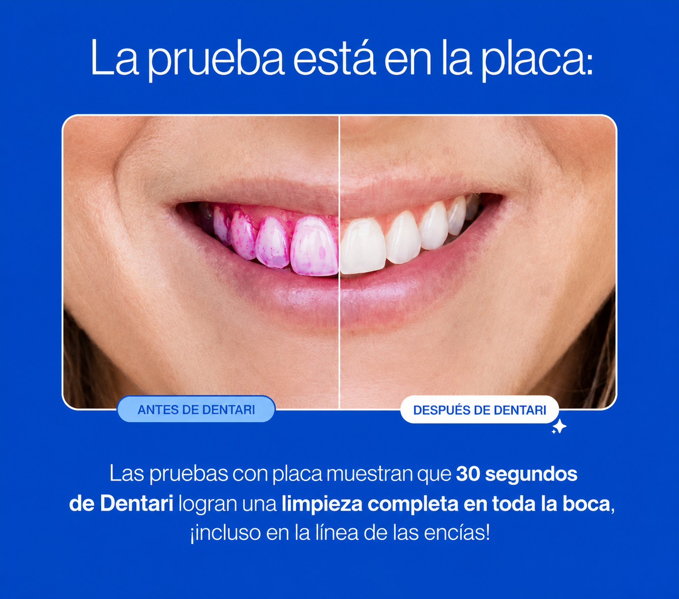 Dentari Cepillo Eléctrico Blanqueador Ultrasonico